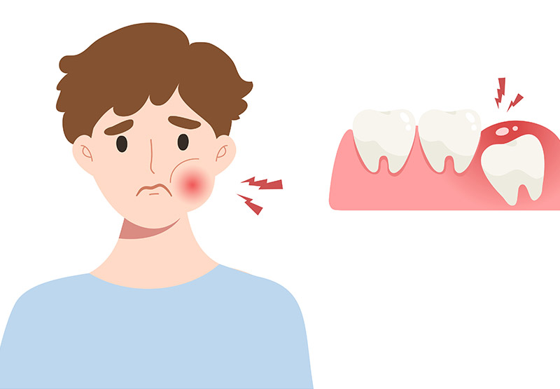 wisdom teeth extractions in red deer